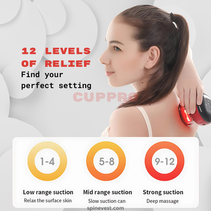 CUPPRO